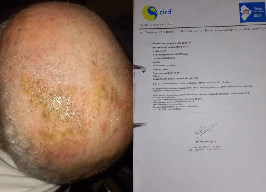 Vecinos cuestionan la calidad del sistema sanitario y reclaman respuestas urgentes a las autoridades.
