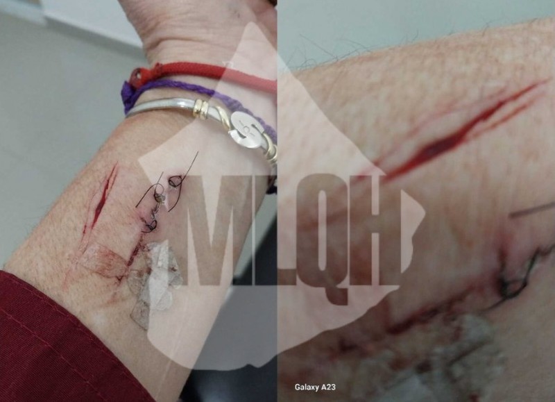 Entre puñetazos y amenazas: la militante de LLA acusa al intendente de Tigre.