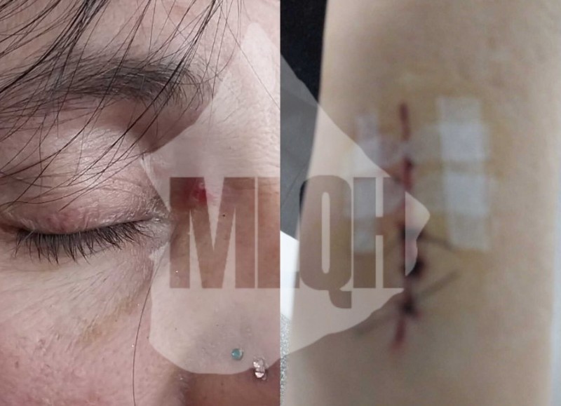 Gabriela Bettiga, militante de La Libertad Avanza, denunció que fue golpeada brutalmente este domingo y responsabilizó al intendente y candidato a legislador Julio Zamora.