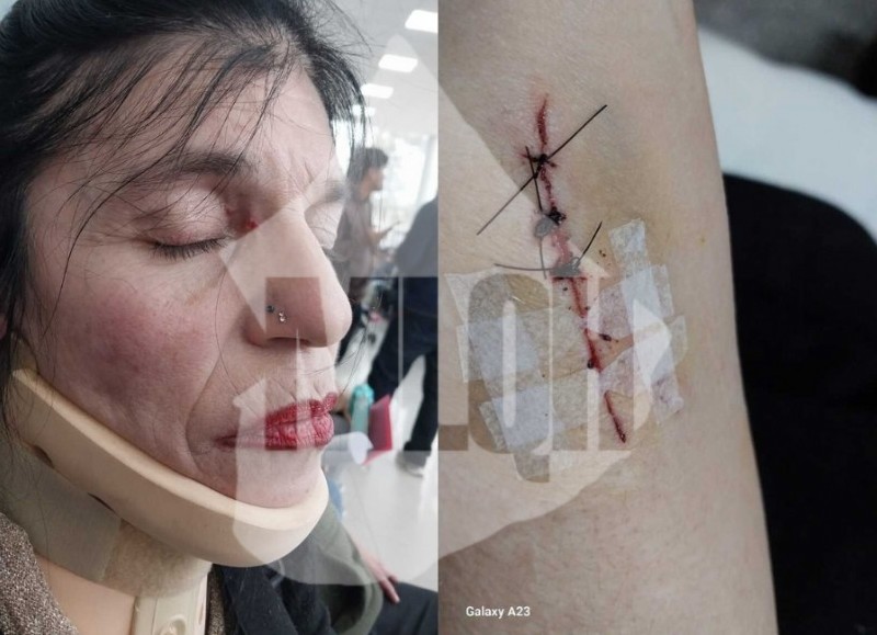 Agresión en Tigre: Gabriela Bettiga responsabiliza a Julio Zamora.