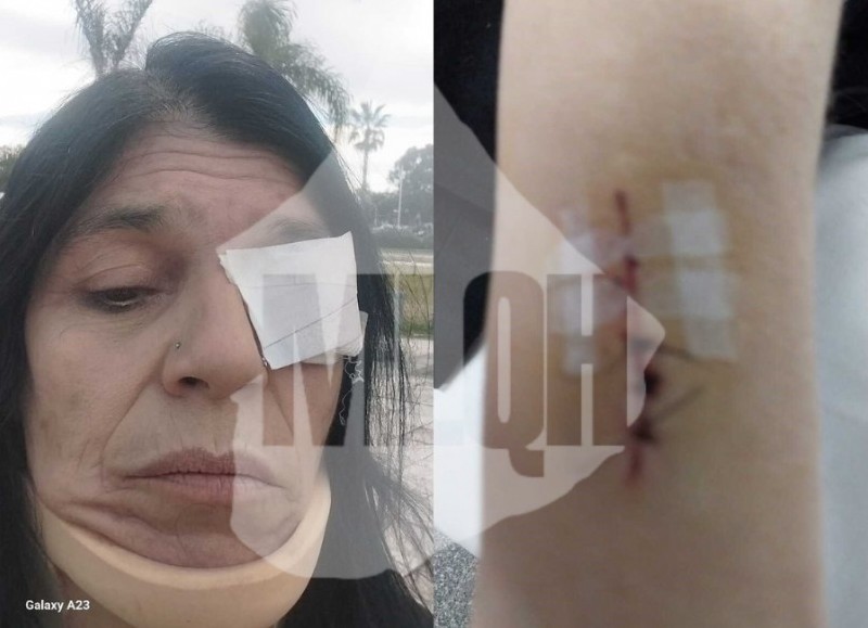 Gabriela Bettiga aseguró haber sido golpeada el domingo por personas que, según ella, actuaron por orden del jefe comunal y candidato a legislador bonaerense.