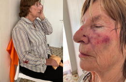 Mar del Plata investiga la feroz agresión a una mujer mayor y a su hija durante un asalto en plena tarde