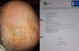Vecinos de General Paz apuntan al Hospital Campomar por negligencia