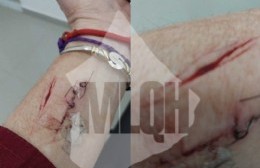 Militante acusa a la intendencia de Tigre por un ataque que dejó heridas graves